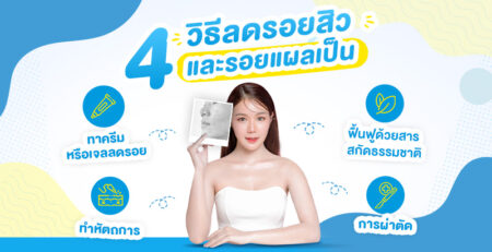 Hiruscar - วิธีลบรอยแผลเป็นบนหน้า และที่อื่น ๆ