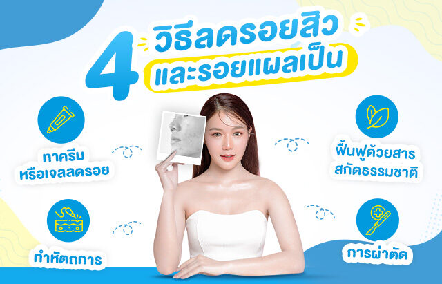 Hiruscar - วิธีลบรอยแผลเป็นบนหน้า และที่อื่น ๆ